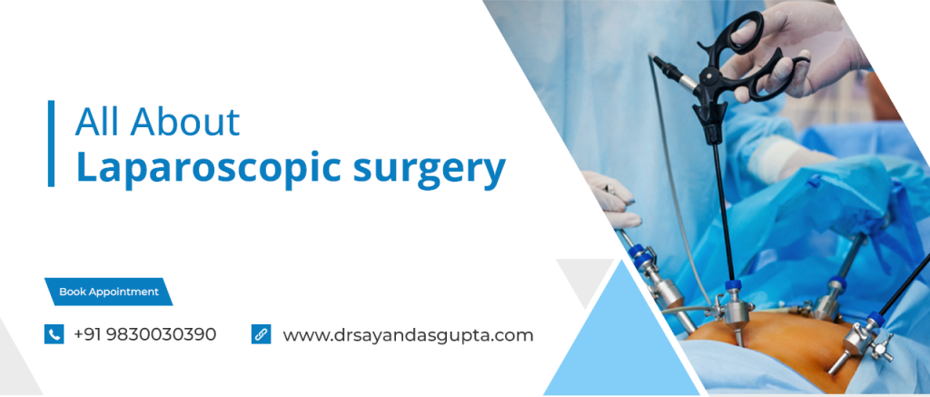 ALL ABOUTE LAPROSCOPIC SURGERY BANNER