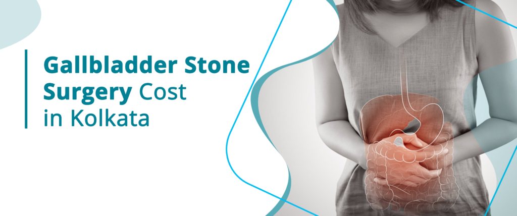 Gallbladder-Stone-Surgery-in-Kolkata