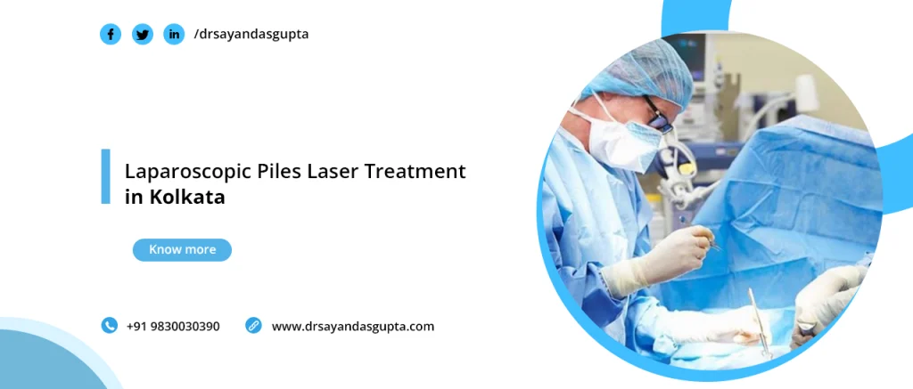 Laparoscopic-Piles-Laser-Treatment-in-Kolkata