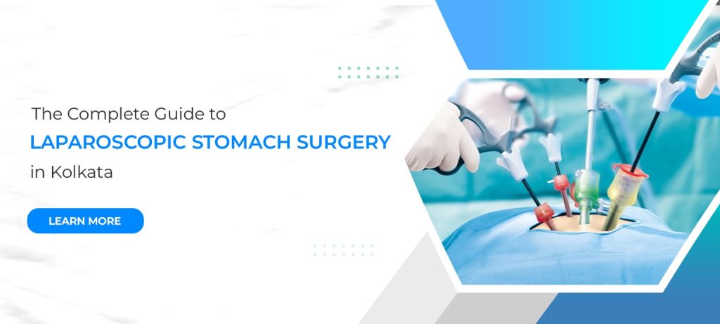 Laproscopic Hernia Surgery in Kolkata