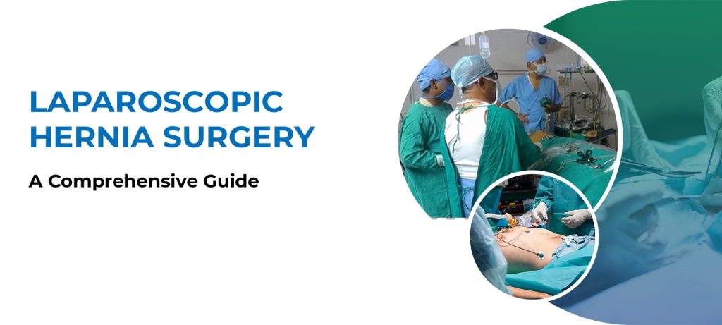 Laproscopic Hernia Surgery in Kolkata